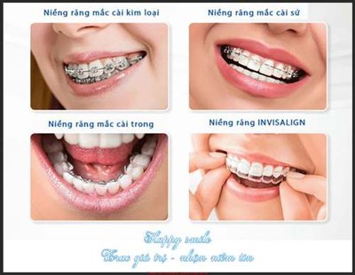 File gốc File gốc in bộ tranh decor treo tráng gương canvas GB18190 (in tráng gương) sang trọng