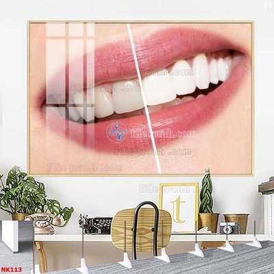 File in trần File gốc tranh in nha khoa NK113 (bản gốc) trời sao