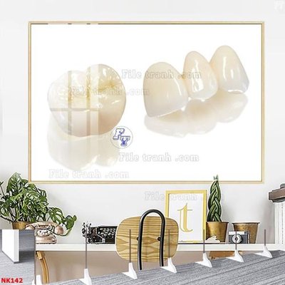 File tranh gốc in trần nhà File gốc tranh in nha khoa NK142 3D