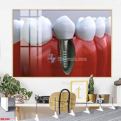 File in ấn File gốc tranh in nha khoa NK184 (bản gốc) chất lượng cao