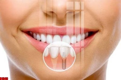 File tranh file tranh in treo tường file decor tổng hợp R1840 (bản gốc) treo phòng ăn