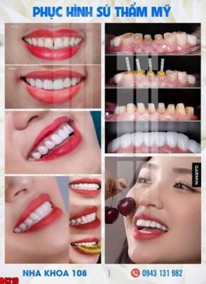 File gốc file tranh in treo tường file decor tổng hợp R4219 (cho in 3D) độc đáo