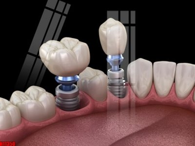 Download file gốc File tranh gốc in tranh tường nền tổng hợp H11350 (in mica) trang trí