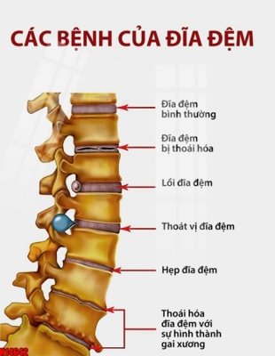 File gốc File tranh gốc in tranh tường nền tổng hợp H14642 (in lụa) tranh thuận buồm