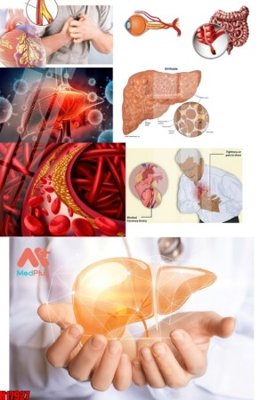 Download file gốc File tranh gốc in tranh tường nền tổng hợp H17927 (in mica) trong suốt