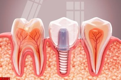 File ảnh File tranh gốc in tranh tường nền tổng hợp H33801 (gốc) trang trí khách sạn