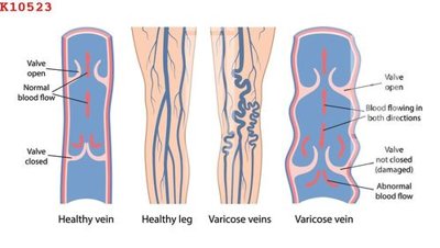 File gốc File gốc in tranh tổng hợp K10523 (PNG) trong suốt (transparent)