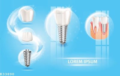 Tải file File gốc in tranh tổng hợp K33890 (gốc) in ấn ngay lập tức