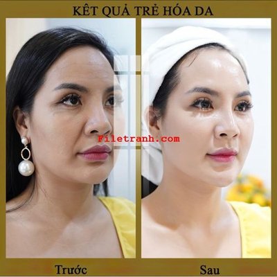 File tranh File gốc in tranh nền tường tổng hợp K63250 (bản gốc) in canvas