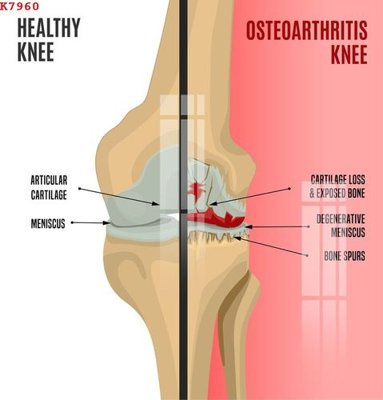 File tranh File gốc in tranh tổng hợp K7960 (bản gốc) treo phòng ăn