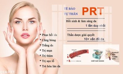 File tranh in trần 3D File gốc in tranh tổng hợp Q16737 (ảnh gốc)