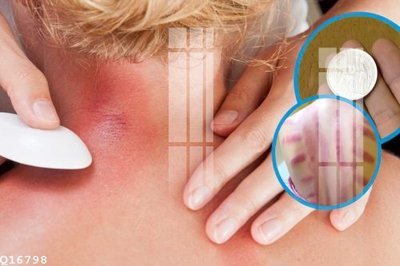 File in mica File gốc in tranh tổng hợp Q16798 (bản gốc) sắc sảo